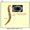   (Hook worm)